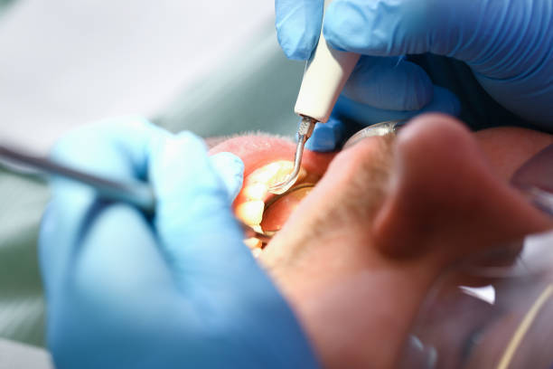 Best After-Hours Dental Trauma Care in , ND